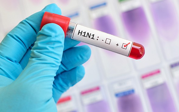 H1N1 influenza virus